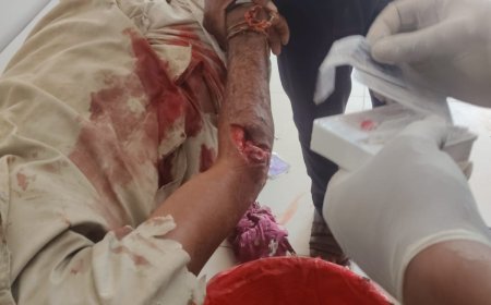 लाडपुरा गांव में भालू के हमले से ग्रामीण घायल, सोजत अस्पताल में उपचार जारी
