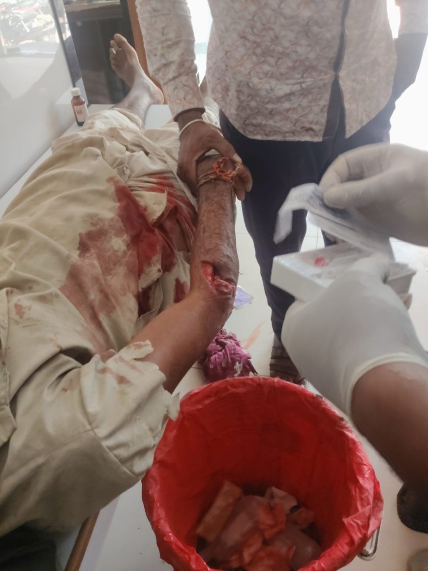 लाडपुरा गांव में भालू के हमले से ग्रामीण घायल, सोजत अस्पताल में उपचार जारी